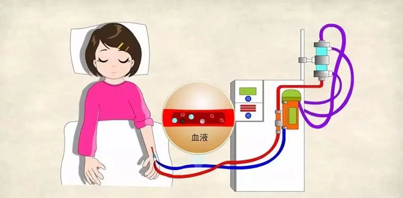 血透病人如何保护好“生命线”