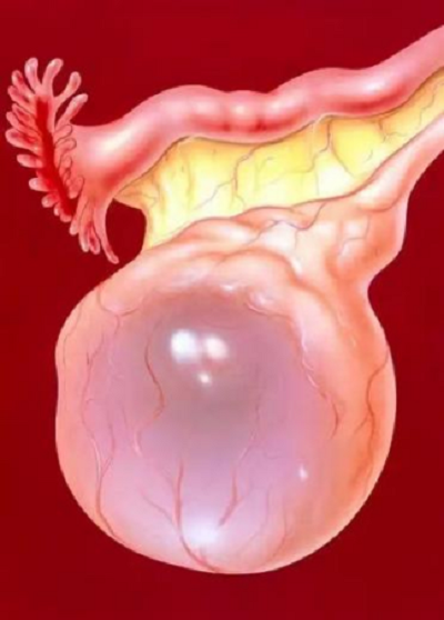 单孔腹腔镜：藏在肚脐里的&ldquo;隐形手术&rdquo;，年轻女性的健康守护者